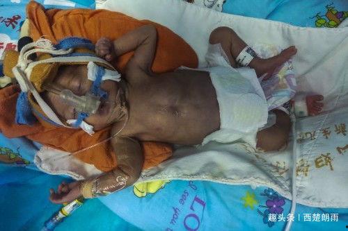 吃吊瓜会早产吗视频,吃吊瓜致早产？揭秘吊瓜与孕期安全之谜